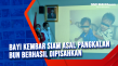 Bayi Kembar Siam Asal...
