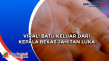 Viral! Batu keluar dari...