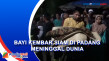 Bayi Kembar Siam di...