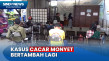 Temuan Kasus Cacar Monyet...