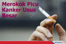 STOP! Kebiasaan Merokok...