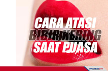 Cara Mengatasi Bibir...