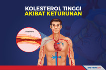 Cara Atasi Kolesterol...
