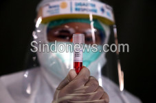 Memungkinkan Donor Plasma...