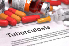 Kasus Tuberkulosis di...