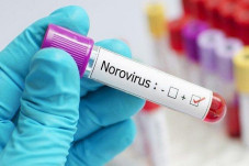 Norovirus Menyebar dengan...