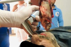 Dokter Keluarkan Ikan...