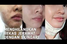 Gak Pede dengan Bekas...