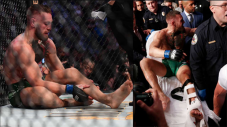 Operasi Patah Kaki Selesai,...