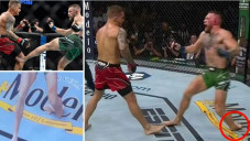 Conor McGregor Patah...