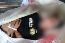 Jatuh dari Mobil Pikap...