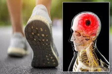 Gejala Stroke saat Berjalan...