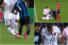 Cedera Kylian Mbappe...