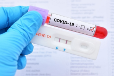 Cek Penyebaran COVID-19,...