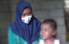 Bayi Ini Alami Penyakit...