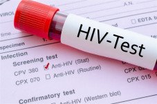 Tes HIV Harus Dilakukan...
