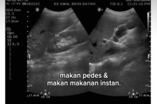 Kisah Pilu Wanita Idap...
