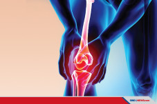 Mantap, Osteoartritis...