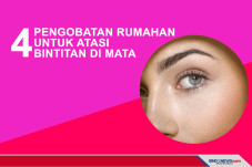 4 Pengobatan Rumahan...