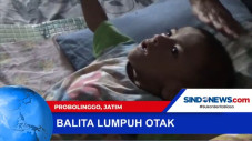 Divonis Lumpuh Otak...