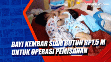 Bayi Kembar Siam Butuh...