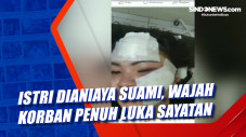 Istri Dianiaya Suami,...