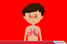 4 Fakta Pneumonia pada...