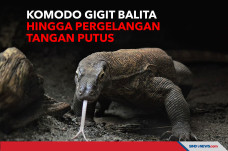Komodo Gigit Balita...