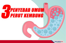 3 Penyebab Umum Perut...