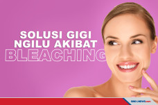 Sering Bleaching Gigi...