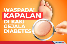 Salah satu Gejala Diabetes...