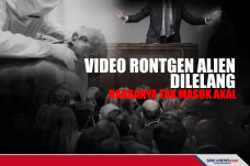 Video Rontgen Alien...