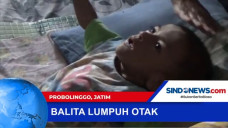 Divonis Lumpuh Otak...