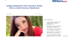 Model Jadi Korban Dugaan...