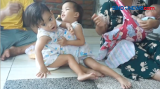 Balita Kembar Siam Jalani...