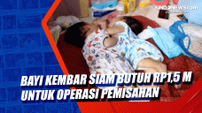 Bayi Kembar Siam Butuh...