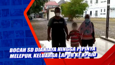 Bocah SD Dianiaya hingga...