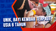 Unik, Bayi Kembar Terpaut...
