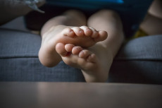 Waspada! Lesi Kaki pada...