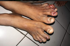 Sadis! Bocah Disabilitas...