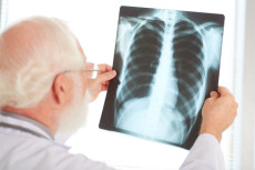 Diagnosis Dini dan Pengobatan...