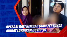 Operasi Bayi Kembar...