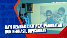 Bayi Kembar Siam Asal...