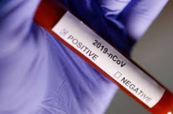 Hasil Rapid Test 400 Orang, 23 Orang di Prabumulih Positif Corona