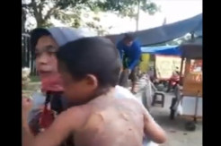 Kisah Balita di Tegal yang Tersiram Air Panas usai Dimandikan