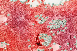 Mutasi Virus Corona Berbahaya Ternyata Bawa Harapan untuk Vaksin Lebih Baik