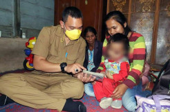 Bupati Pakpak Bharat Siap Alokasikan Gajinya untuk Perawatan Balita Penderita Tumor Mata