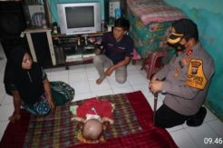 Kapolres Batubara Kunjungi Kediaman Bocah Penderita Hidrosefalus