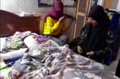 Gadis Cantik di Disiram Air Keras Kekasihnya Sendiri yang Selalu Merasa Tersakiti