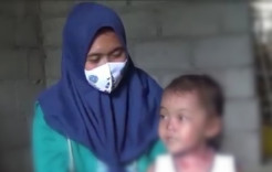 Bayi Ini Alami Penyakit Kulit Aneh, Bisul Kembali Muncul Setelah Keluar Darah dan Nanah